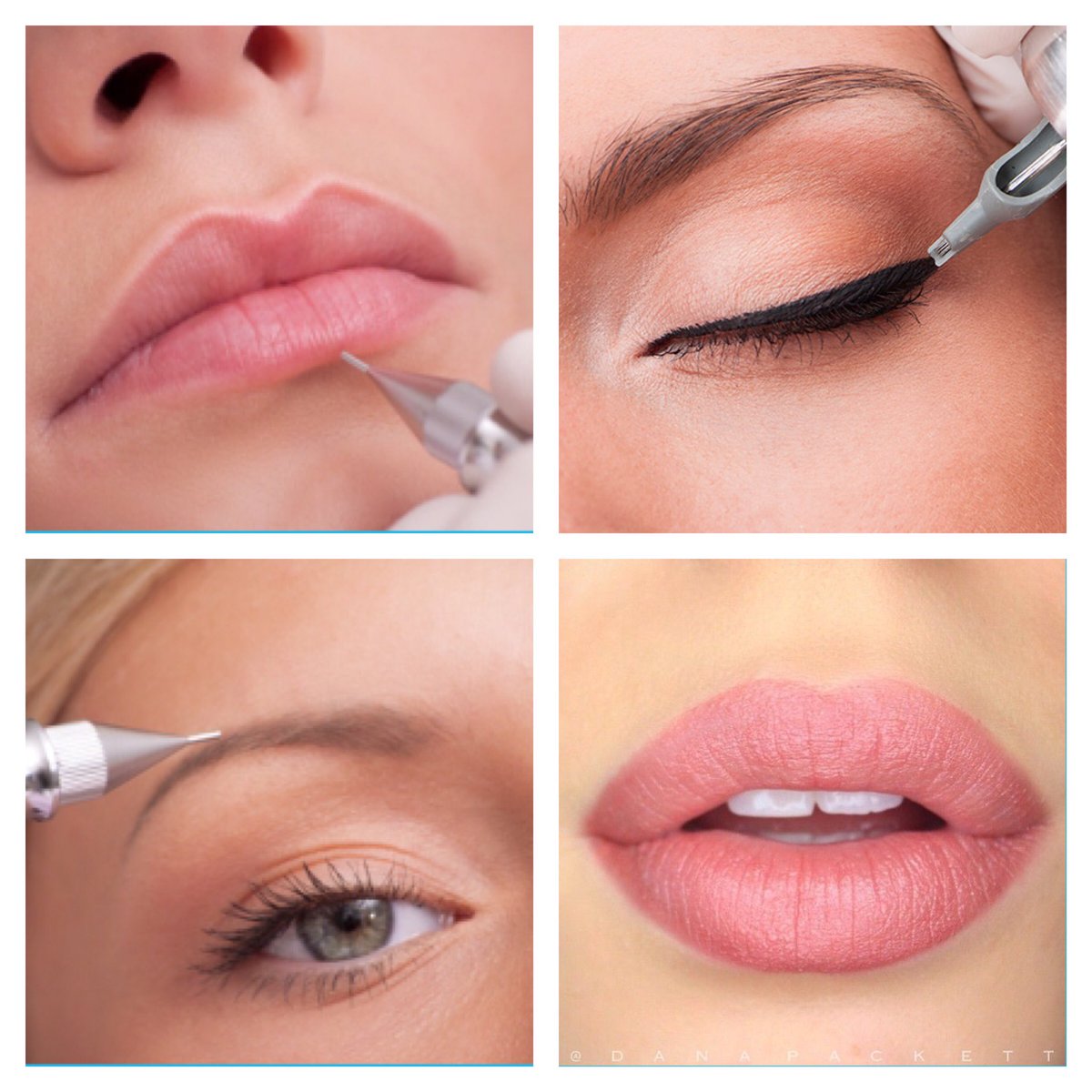 Permanent Make-up ist eine kosmetische Tätowierung, die darauf abzielt, bestimmte Gesichtspartien wie Augenbrauen, Augenlider und Lippen dauerhaft zu verschönern.