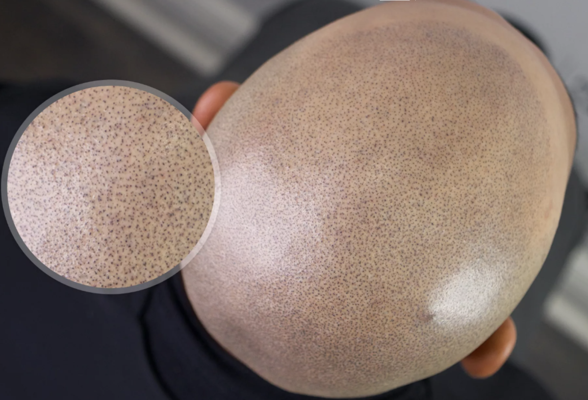 Was ist eine Pigmentierung Haare